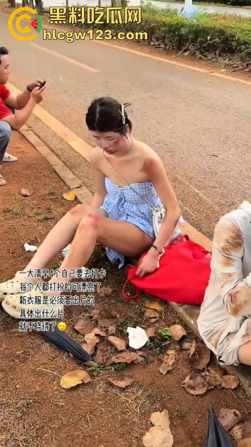 一生要强的中国女人，就算出车祸一身伤，也是必须要出片，不管摔成什么样拍照才是第一位！-2