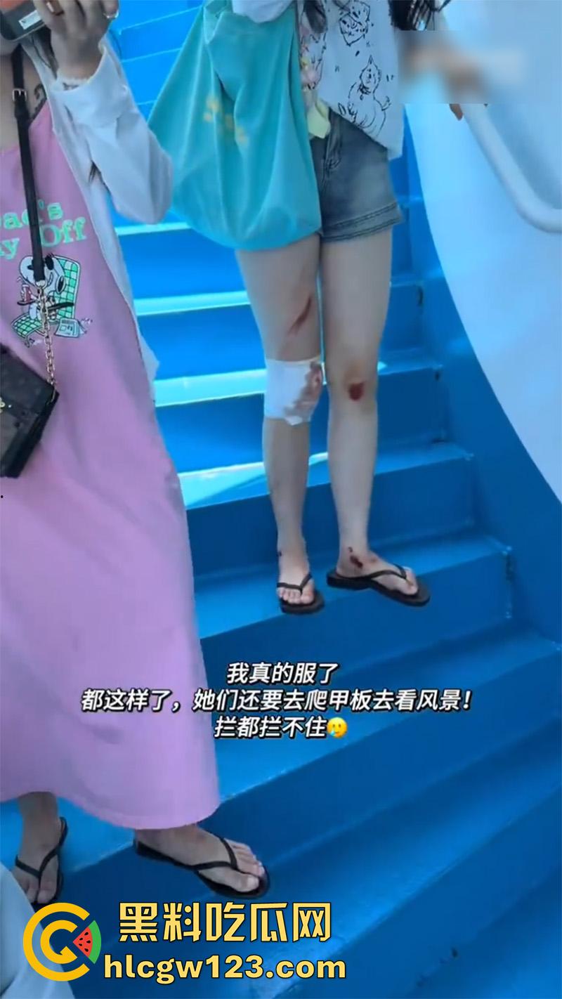 一生要强的中国女人，就算出车祸一身伤，也是必须要出片，不管摔成什么样拍照才是第一位！-7