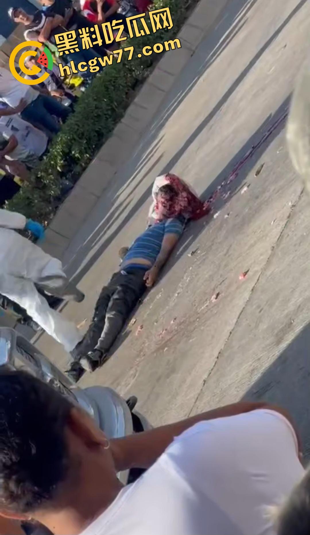 蓝色衣服男电动车车祸爆头血腥惨剧！眼珠弹出还能救？世上竟有神人？-1