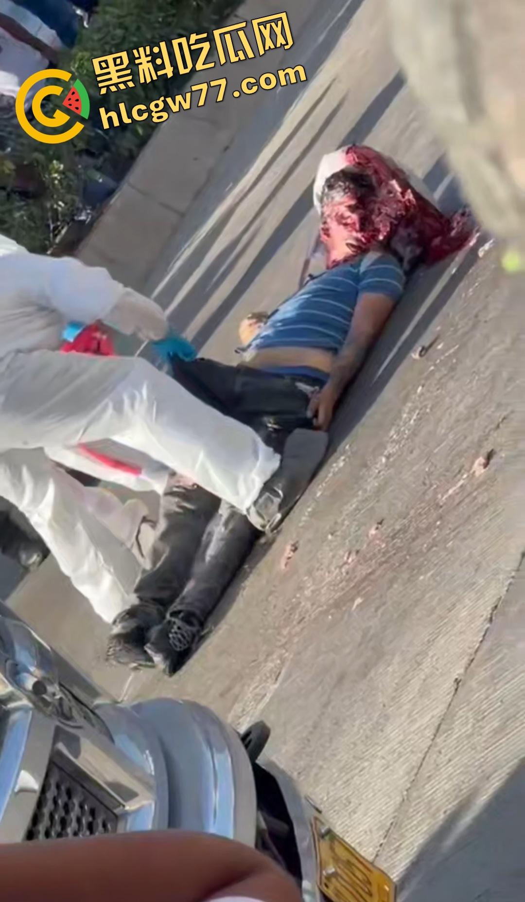 蓝色衣服男电动车车祸爆头血腥惨剧！眼珠弹出还能救？世上竟有神人？-2