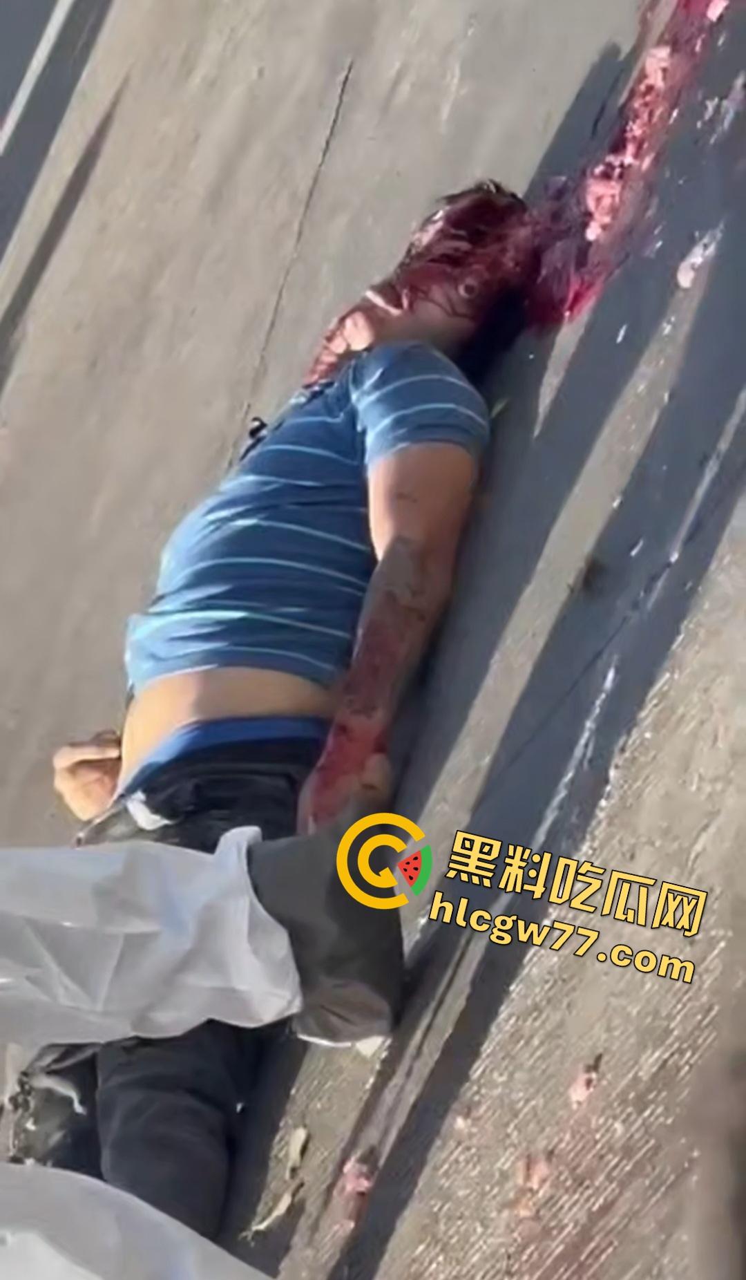 蓝色衣服男电动车车祸爆头血腥惨剧！眼珠弹出还能救？世上竟有神人？-5
