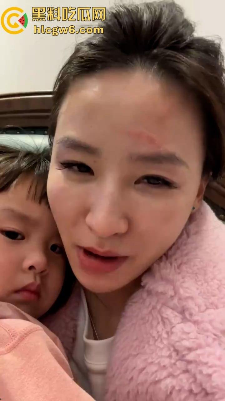 湖北一小学美女老师抖音自曝离婚探女遭前夫爹殴打抓脸全身多处受伤 伤情实拍曝光！都是血口子-4